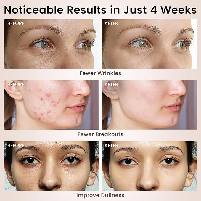 LED Face Mask Light Therapy, 4 Modes Portable Red Light Therapy Infrared Light for Face with 2600mAh Rechargeable, IP67 Washable, 216 LEDs for Anti-Aging, Skin Firming & Radiant Glow at Home