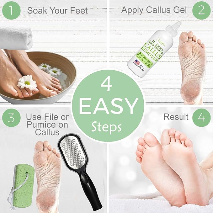 Dr. Entre's Callus Remover Gel Kit for Feet: Foot File, Pumice Stone, 5 Glove Pairs for Gel Application, Spa Kit, Foot Care, Pedicure Tools, Scrubber, 8oz