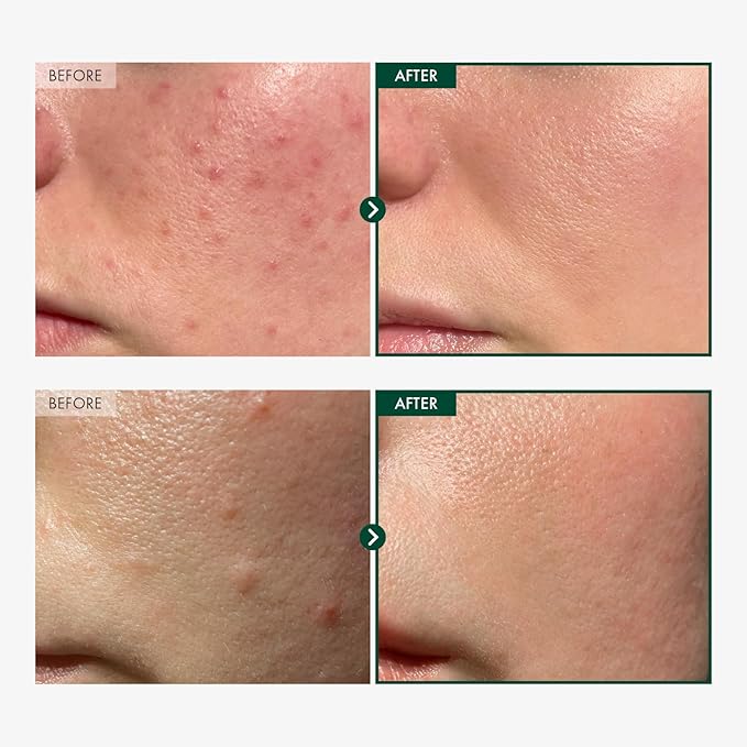 TOSOWOONG Madagascar Centella 86% Ampoule with 860,048ppm Centella Asiatica, Soothing, Calming, Facial Serum for face, for All Skin Types, Korean Skin Care, 100ml, 3.38 fl.oz.