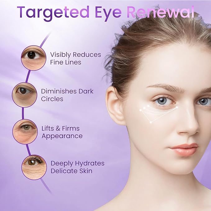 Retinol Under Eye Cream for Dark Circles & Puffiness – Anti-Aging Eye Cream for Fine Lines & Wrinkles, Hydrating Under Eye Cream for Men & Women, 1.06 Fl Oz