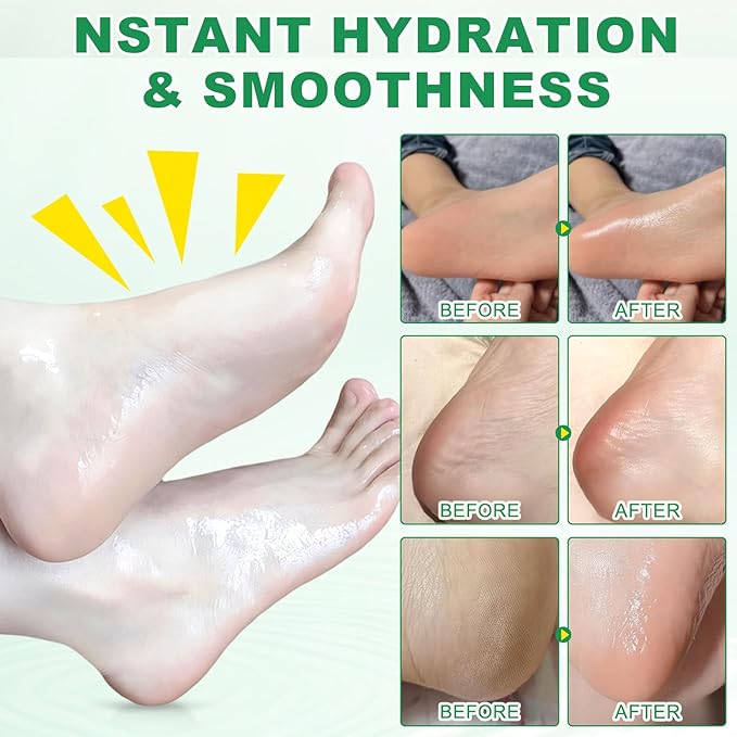 2PCS Foot Cream with Aloe Vera 2.46 oz/70 g, Heel Stick, Moisturizing Foot Balm, Crack Feet Prevention Stick for Removing and Smoothing Cracked Hands Elbows Feet, Moisturizes and Hydrates the Dry Skin