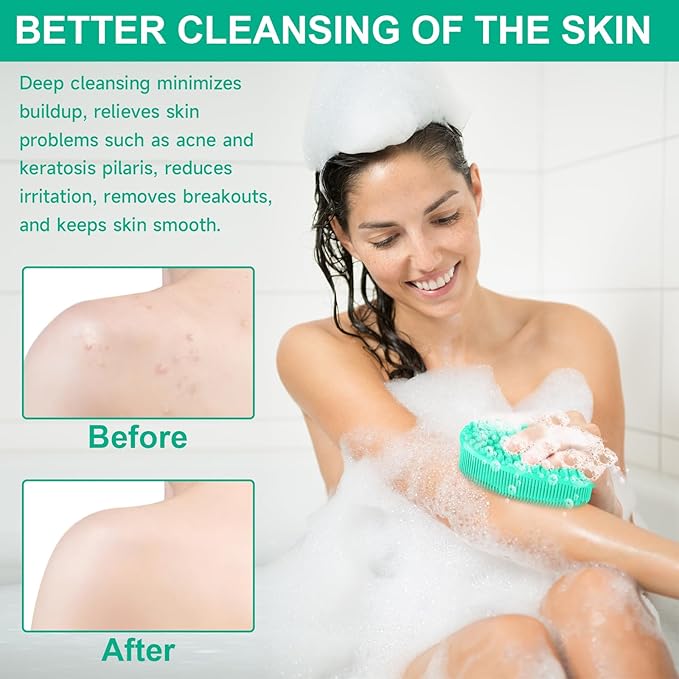 Metene Silicone Exfoliating Body Scrubber with Loop, Body Scrubber for Men and Women, Silicone Loofah for Shower, Soft Silicone for Shower and Bath Skincare Routine(Green)