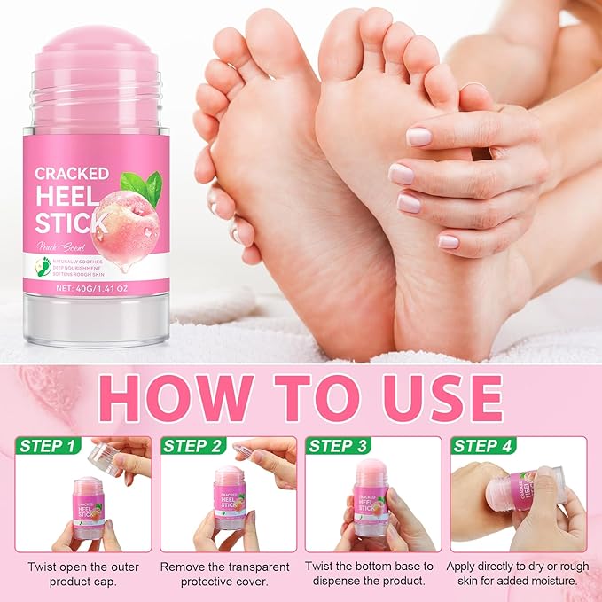 Urea Cream Foot Callus Remover Stick - 60% Urea with 2% Salicylic Acid, Professional Strength Moisturizer for Dry Cracked Feet, Heels, Knees, Elbows & Hands, Callus Removal & Skin Softening Treatment