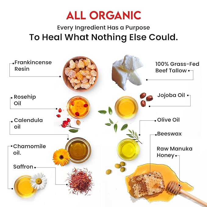 Whipped Tallow Honey Balm – Grass-Fed Beef Tallow infused with Organic Manuka Honey, Rosehip, Jojoba & Olive Oils – Nourishing Face, Neck & Body Lotion, 100% Organic (Frankincense Scent - 2 oz)