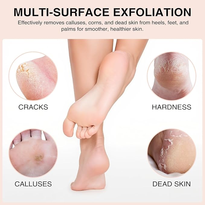 Natural Pumice Stone Set - 3-Pack Oval-Shaped Volcanic Lava Foot Scrubber Files for Callus, Corn, Cracked Heel, and Dead Skin Exfoliation, 4 x 2.8 x 1.6 Inches