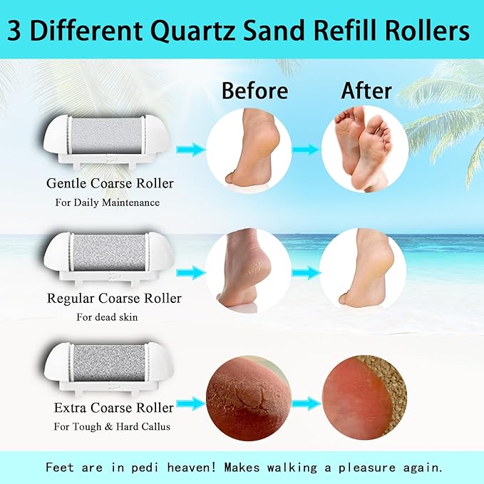 Electric Callus Remover for Feet, Long Service Time Foot Scrubber, Rechargeable Electronic Foot Files, Professional Pedicure Tools Pedicure Kit Feet Care for Crack Heel, Women Gift (White)