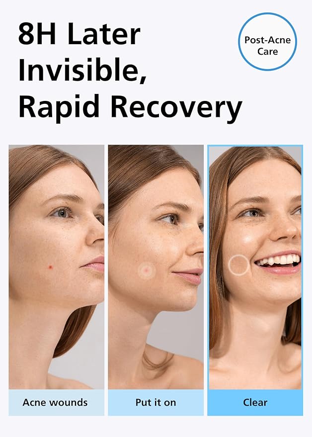 EasyDerm Beauty Patch(84 Counts) - 100% Hydrocolloid Pimple Patch for Zit Spot Care, K-beauty, Daewoong Pharmaceutical, Korean Acne Patches Stocking Stuffer Holiday Gift