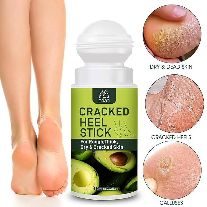 Daily Foot Moisturizer Cream, Feet Cream for Dry Cracked Heels Knees Elbows Hands, with Salicylic Acid & Macadamia Ternifolia Seed Oil & Shea Butter, Deeply Moisturize and Remove Calluses, 1.763 Fl.Oz