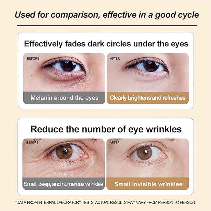 PORCOPE Caffeine Dark Circle Eye Cream - Contains Hyaluronic Acid & Niacinamide Under to Brighten Eye Area, Reduce Dark Circles & Smooth Wrinkles - Caffeine Eyes Serum 0.5 fl oz