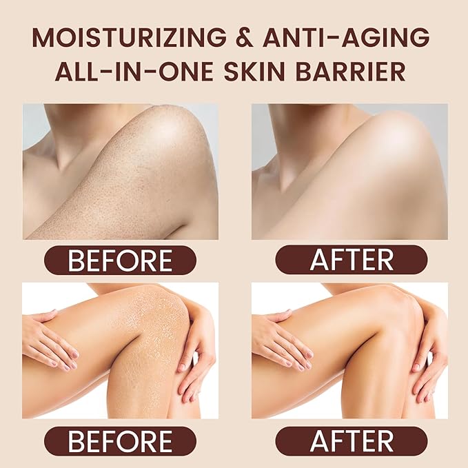 Body Butter for Rough Dry Skin - Deep Hydrating Treatment That Absorbs Rapidly, Non-Greasy Daily Moisturizer for Long-Lasting Nourishment with Cocoa & Shea Butter, Silky Smooth Skin, 100g/3.527oz