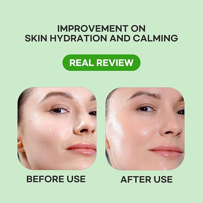 Epielle Heartleaf Calming Serum Sheet Masks (5pk) | Korean Skincare | Facial Sheet Mask | Kbeauty, Spa Gifts for Women