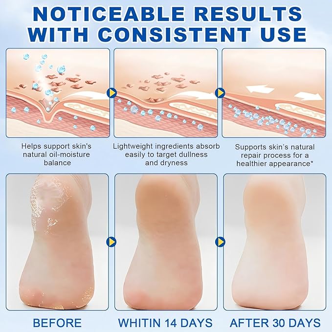 Urea foot Cream Stick 60% plus 2% Salicylic Acid，foot urea cream Deeply Moisturising and Fast Absorbing Gentle Exfoliation For Dry sink Exfoliating Dead Skin, Callus Remover ， Skin Softener