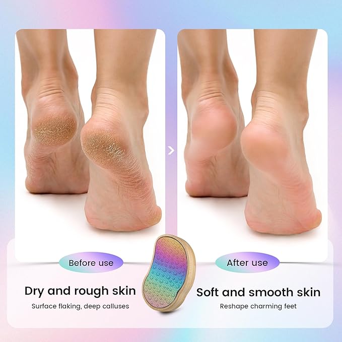 BEZOX Stainless Steel Pedi Egg Foot File Callus Remover for Dry and Wet Feet, Smooth Rough Skin, Plastic-Free Pedicure Tool Pumice Stone, Washable Foot Scrubber for Cracked Heels - Rainbow