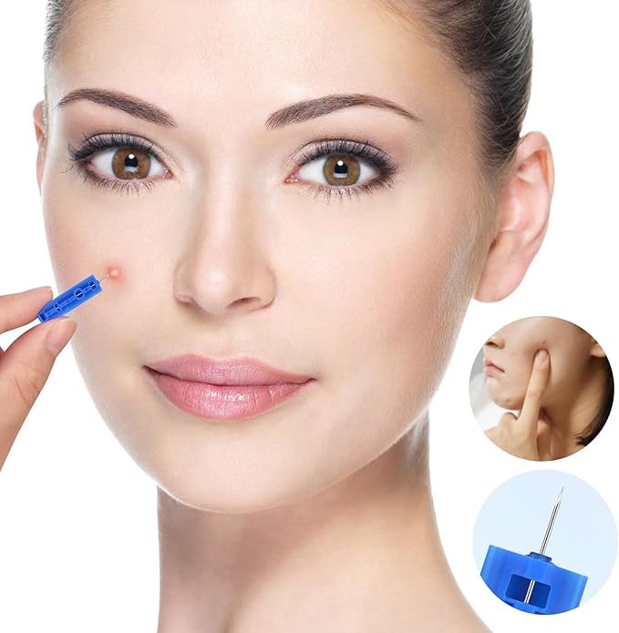 Acne Needle, 50 Pcs Disposable sterile Needles and 70 Dots Pimple Stickers for Acnes, Whitehead, Comedone Removal (122 Piece Set)