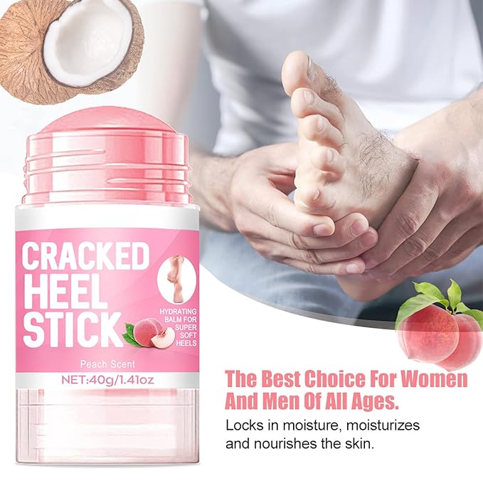 2Pcs Crack Feet Prevention Stick, Hydrating Heel Balm for Dry Cracked Feet,Moisturizing Foot Care Cream, Foot Balm Stick Intensive Repair Feets,Hands,Heels,Elbow and Knees and Softening Dry Skin