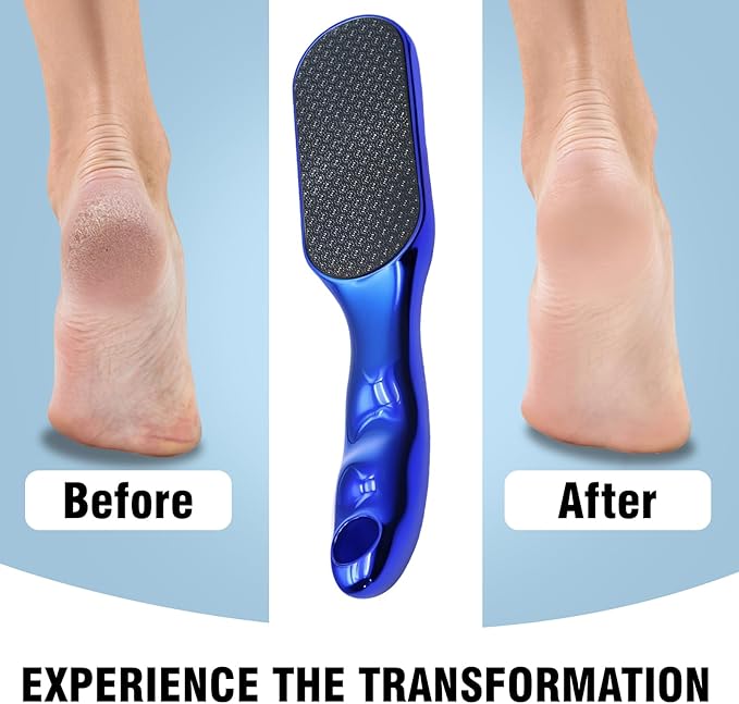 2 Pcs Veinsgrain Foot File, Nano Glass Foot File Hard Skin Remover with Non-Slip Ergonomic Handle, Professional Foot Care Tools for Smooth Feet(Gold+Blue)