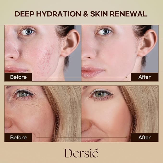 Dersie Tallow and Honey Balm for Face: 100% Grass-Fed Whipped Tallow Balm with Manuka Honey for Dry, Sensitive & Mature Skin – Deep Hydration & Soothing – Suitable for Women, Men & Kids (2.1 oz)