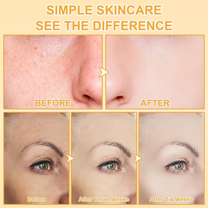 Beef Tallow for Skin, Natural Tallow Balm Face & Body Solid Moisturizer with Raw Honey and Beeswax, Grass-Fed Beef Tallow & Raw Wild Honey Blend, Hydrating Body Lotion for Nourishment,100G/3.5OZ (1PC)