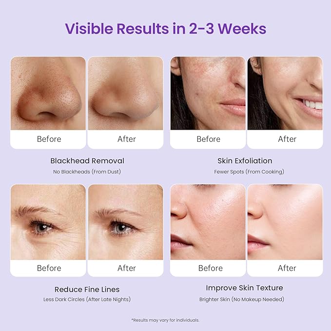 UNOISETION Diamond Microdermabrasion Machine Professional, 3 in 1 Dermabrasion Facial Peeling Skin Care Device for Salon Personal Home Use