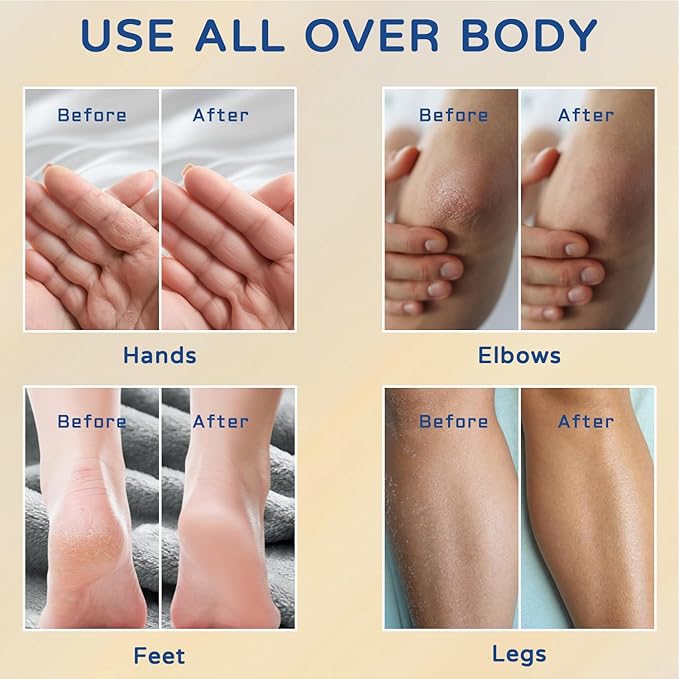 2.65 oz - 60% Urea with 2% Salicylic Acid Foot Hand Cream Stick - for Calluses Dry Hands, Elbows, Knees, Feet & Heels, 60 Percent Urea Lotion for Feet Maximum Strength - Hydrates & Softens Dry Skin