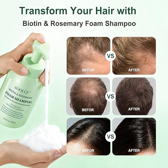 Biotin & Rosemary Shampoo for Hair Growth, Hair Loss Shampoo for Men and Women, 12-Component Synergistic Blend for Visibly Thicker Hair - 13.53 fl oz (Pack of 2)
