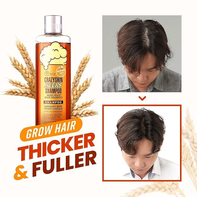 CRAZY SKIN German Beers Yeast Biotin Shampoo for Hard water, Anti-hair loss, and Thickening,Gentle Exfoliating & Scalp Function with Panthenol, Collagen and Free-Sulfate, Chemical, 300ml(10.15oz)