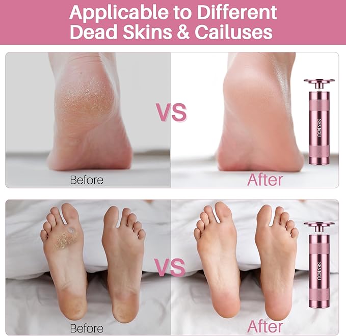 Electric Foot File Callus Remover, 2-in-1 Nail Grinder, Adjustable Speed, 60 Sandpaper Discs, Rose Gold