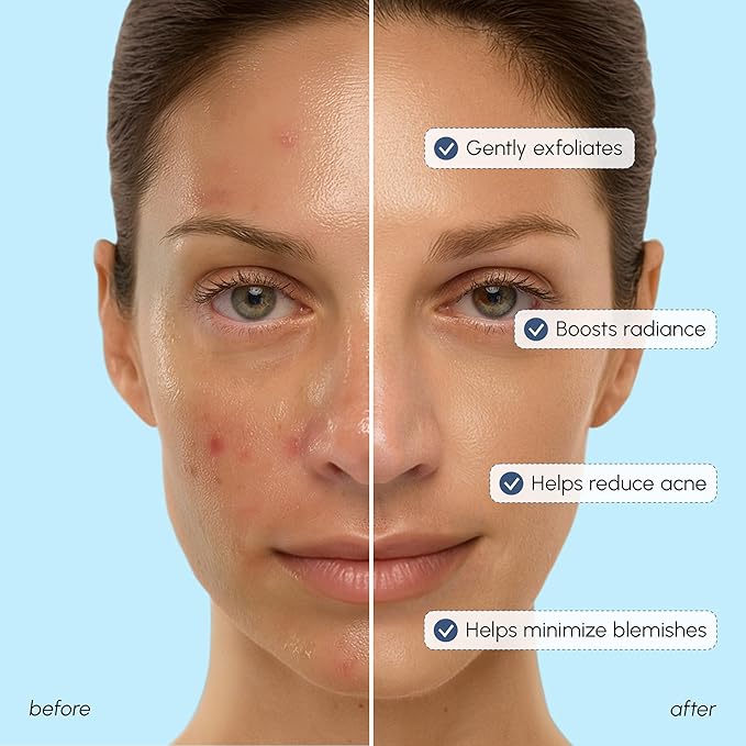 MAREE Toner Glycolic Acid Exfoliating Toner for Face Acido Glicolico para Manchas