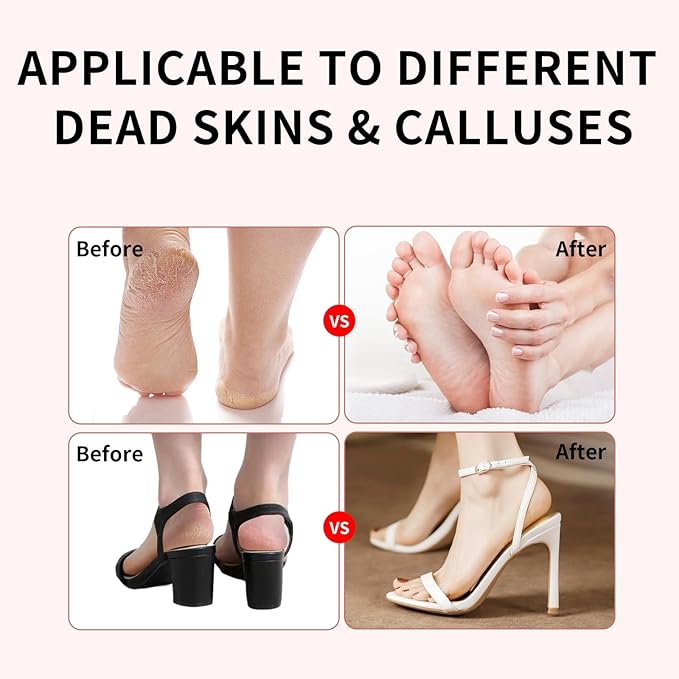 Dermave Electric Foot Callus Remover – Pedicure Tool with 60pcs Sanding Discs, Electric Foot Callus Remover, Callus Remover for Feet - Foot File for Dead Cracked Skin, Men/Women (Pink)