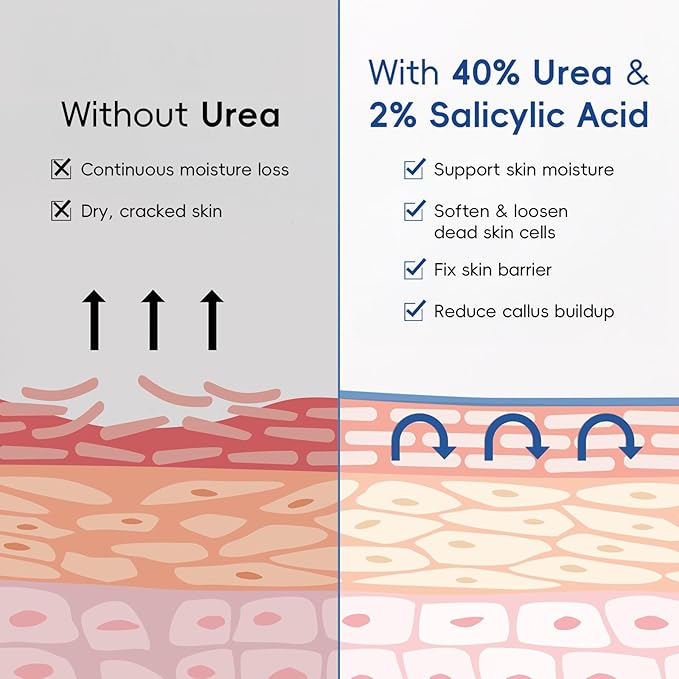 2 Pack Urea Cream 40% + 2% Salicylic Acid, 3.53 oz - Maximum Strength Foot & Hands Moisturizer for Rough, Dry Cracked Skin, Callus Remover with Deep Hydration, Intensive Repair for Feet, Heels