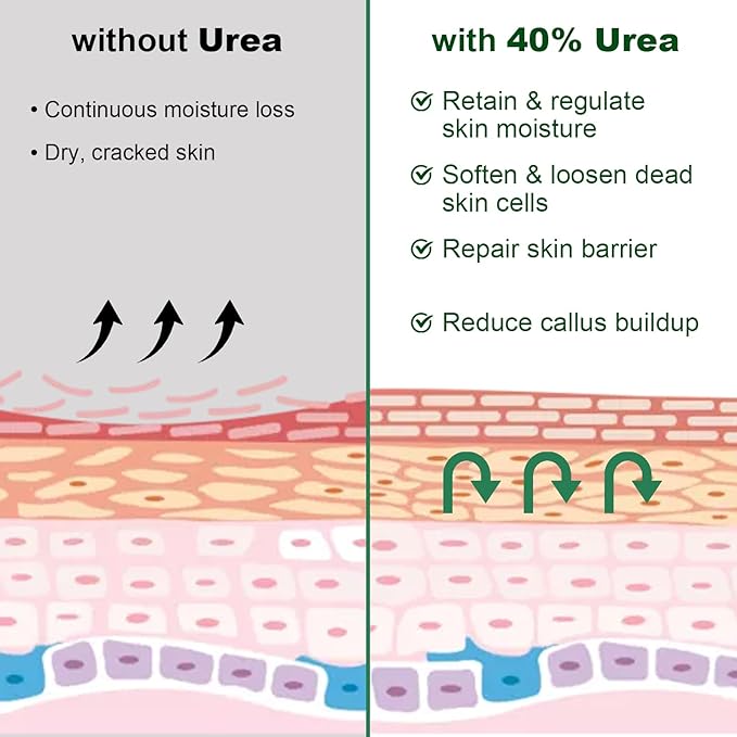 Urea Cream 40 Percent For Feet Maximum Strength, Plus 2% Salicylic Acid with Hyaluronic Acid, Urea Foot & Hand Cream for Dry Cracked, 4.6 oz