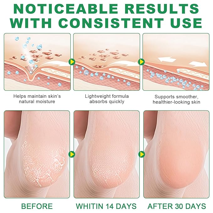 2-Pack 60% Urea Foot Balm Stick, Aloe, Peach Heel Repair Stick, Deep Moisturizing Hand & Foot Cream for Dry, Cracked Heels, Calluses, Rough Skin, Intensive Hydration & Smoothing Treatment (1.41 Ounce)