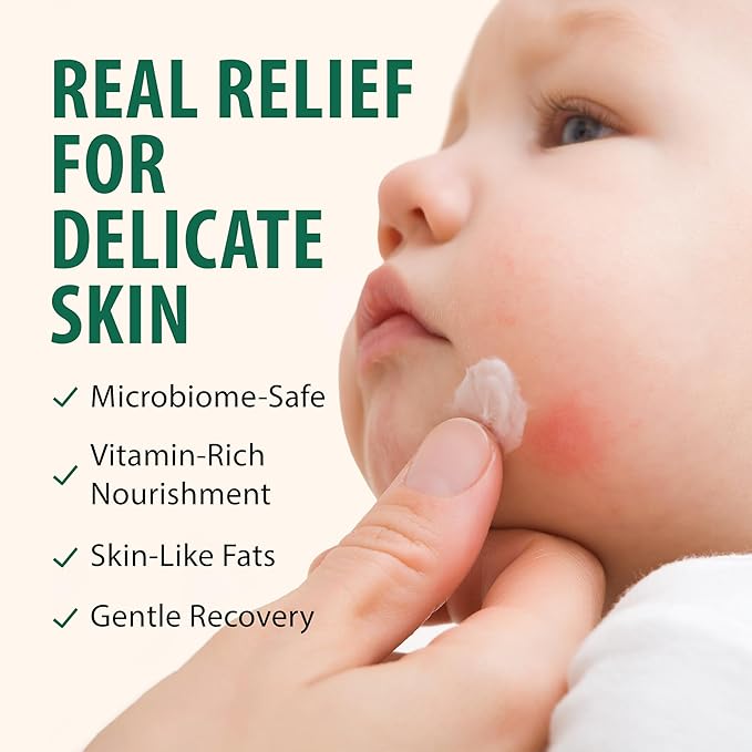 Grass Fed Whipped Beef Tallow for Skin with Manuka Honey - Silky Smooth, Fast Absorbing Tallow & Honey Balm - Ideal for Kids & Eczema Prone Area - Whipped Moisturizer for Dry & Sensitive Skin