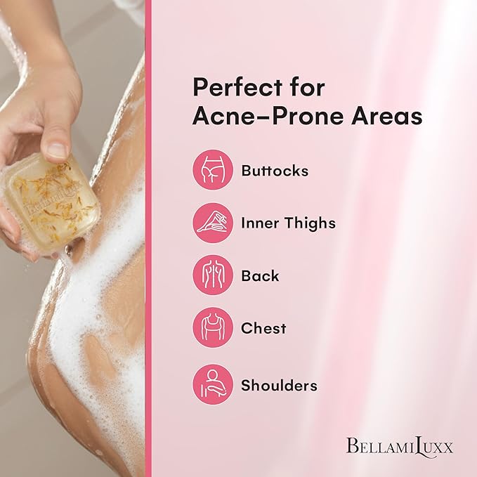 Butt Acne Treatment Set: Acne Soap Bar + Butt Treatment Lotion for Breakouts on Buttocks, Thighs, Back, Chest & Ingrown-Prone & Folliculitis-Prone Skin – Helps Reduce Body Breakouts