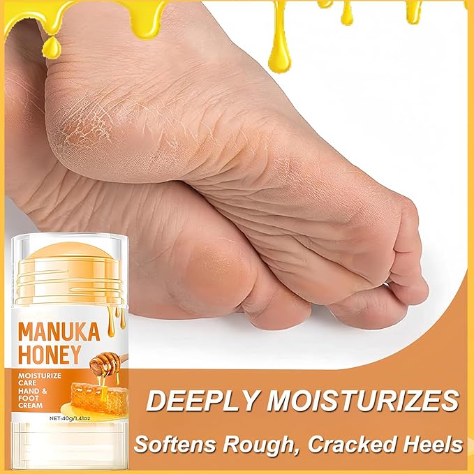 2Pcs Manuka Honey Foot Balm Stick, Moisturizing Hand and Foot Cream for Dry Cracked Heels, Heel Stick Balm for Women & Men, Callus Hydrating Cream for Hands, Elbows & Knees