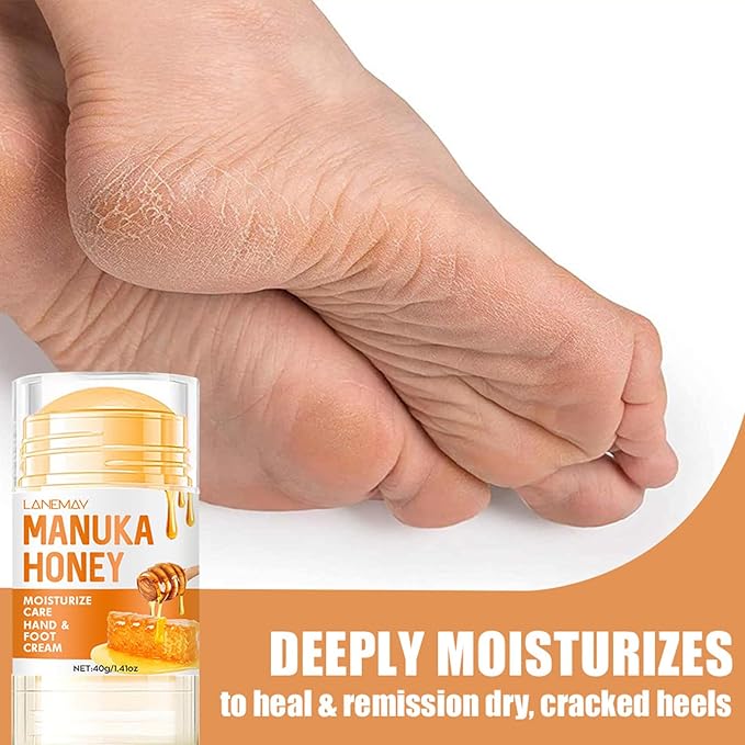 Honey Foot Balm Stick,Manuka Honey Stick Foot Cream for Dry Cracked Heels and Feet Moisturizing & Exfoliating Care for Dry Cracked Feet Knees and Hands Callus 1.41 Oz