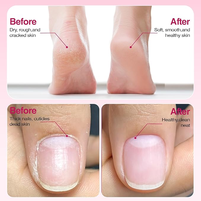 Professional Electric Nail Drill 2000mAH Portable Cordless Electric Nail File 10 in 1 Manicure Pedicure Kit ,5-Speeds Toe Nail Tools Hand Foot Care,Thick Toenail Grinder for Women Men Pets (Pink)