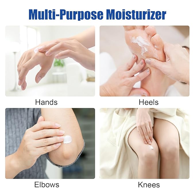 Urea Cream 60% plus 2% Salicylic Acid for Feet Maximum Strength - Lotion For Dry Cracked Feet Elbows Knees Heels Hands, Hydrates Foot Care for Softening and Moisturizing, Callus Remover 10.1oz