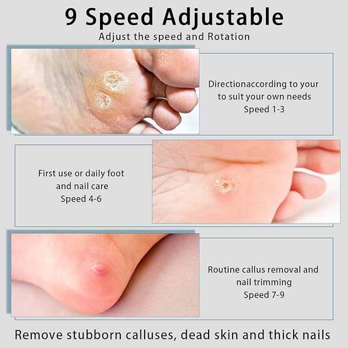 Electric Foot Callus Removers Rechargeable - Electric Foot File with 9 Adjustable Speed, 2 Grinding Heads & 30 Pcs Sandpaper Discs,Professional Foot Sander for Feet Dead Skin and Calluse (Black)