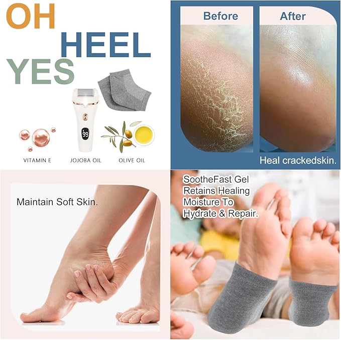 Electric Foot Scrubber File Callus Remover with Socks, Electric Callus Foot Grinder Feet Spa Care Kit for Dead Dry Skin 3 Rollers, 2 Speed, Battery Display