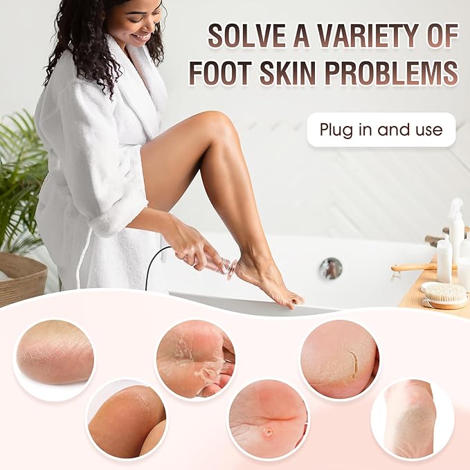 Electric Foot File Callus Remover: Adjustable Speed Feet File Grinder with 60 Pcs Sandpaper Discs - Professional Pedicure Tools for Dead Skin Calluses (Gold)