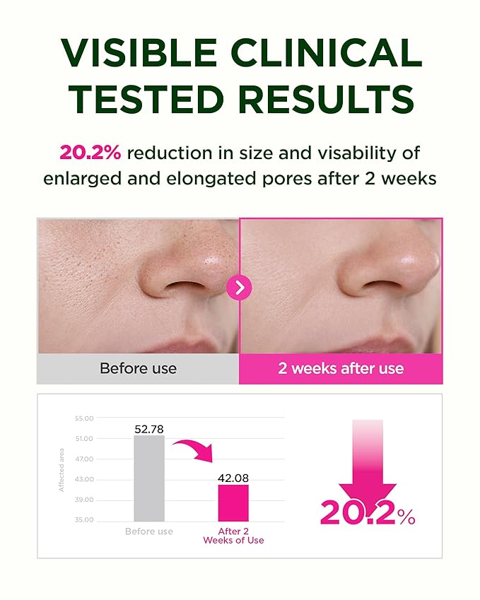 CKD Pore-Tightening & Firming Face Mask (10ea) – Korean Hydrogel Sheet Mask for Glass Skin, Minimizes Pores & Boosts Firmness with 3rd Retinal & Low Molecular Collagen, Korean Skincare