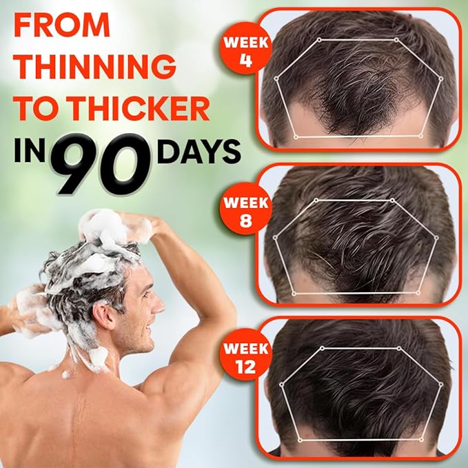 Hair Growth Shampoo - Biotin Infused Natural Botanical Formula with Tea Tree Oil, Ginseng & Mint for Stronger Hair and Healthy Scalp - 10.1 FL.OZ / 300ML