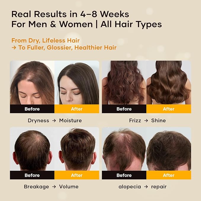 Batana Oil for Hair Growth, Cold-Pressed, Natural & Unrefined, Batana Oil for Dry Damaged Hair, Thinning Hair, Scalp Treatment for Men & Women, Frizz Control, Strength & Shine (4.23 Fl Oz)