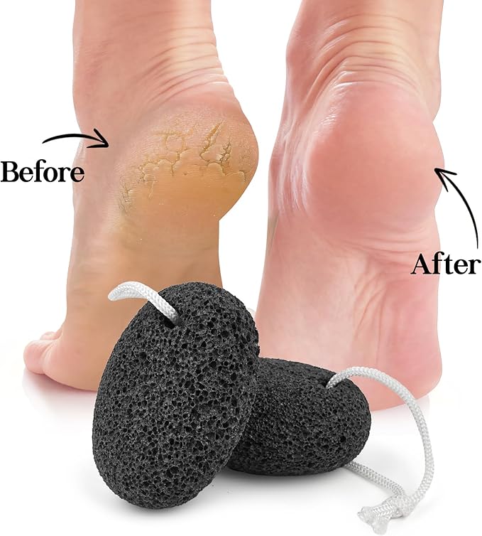 Natural Pumice Stone for Feet - Lava Foot Scrubber Dead Skin Corn Callus Remover Exfoliator Pedicure Tools for Feet Heels and Hands 2 Pack