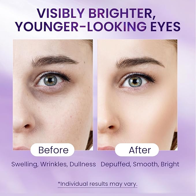 Caffeine & Retinol Eye Serum – Hydrating Under Eye Serum to Help Reduce the Appearance of Dark Circles & Puffiness and Smooth the Look of Fine Lines, 0.7 fl oz