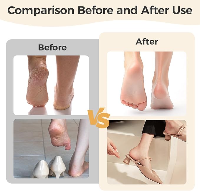 Foot Callus Remover｜Patented 3D Roller + 2-Speed 丨LED｜30,000 RPM High-Frequency Exfoliation｜Portable for Home & Travel｜Stylish Foot Care for Men & Women (Pink)