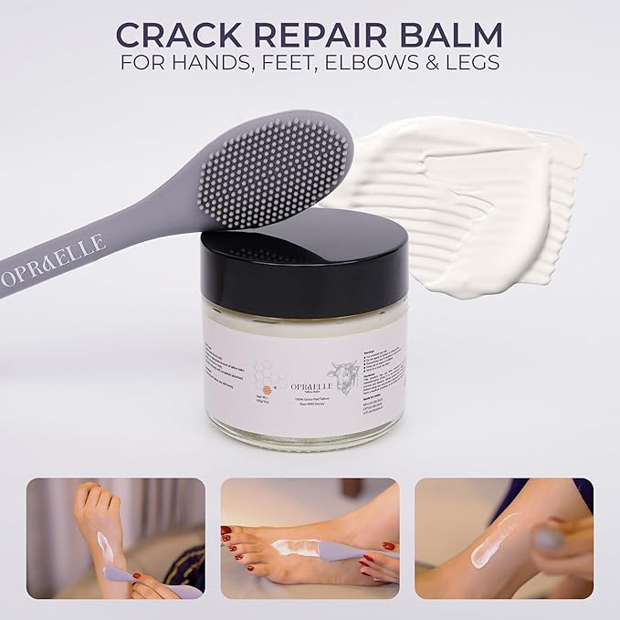 Beef Tallow Moisturizer for Face & Body – Tallow & Honey Balm for Deep Hydration – 100% Natural Skin Cream for Dry, Sensitive & All Skin Types, Nourishing Moisturizing Balm – 2oz + Applicator