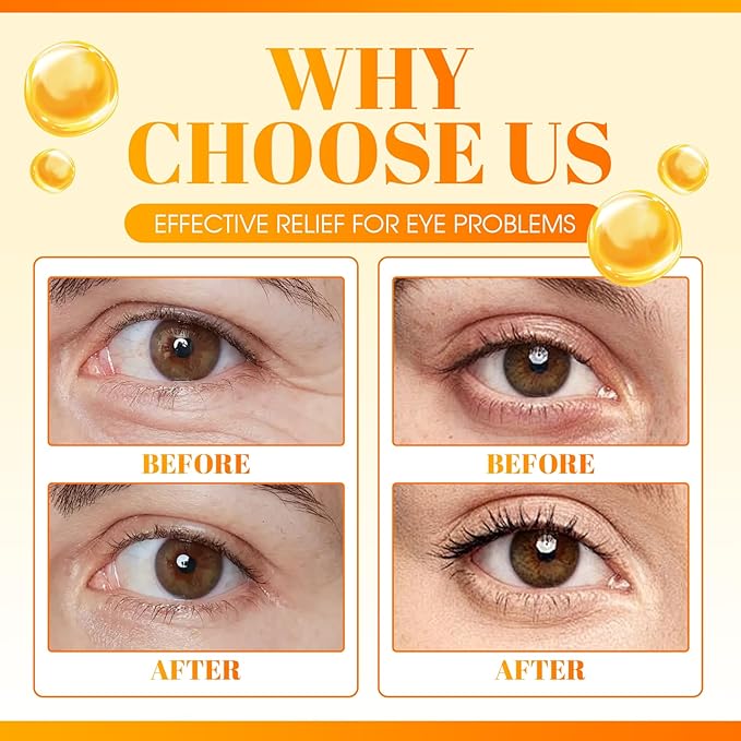 Vc Anti-Wrinkle Eye Serum Oil,Lutein Oil for Eyes for Women & Men with Roller,Suit for Dark Circles & Puffiness,Firming Anti-Aging (2 pack)