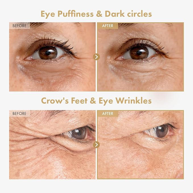 TOSOWOONG Ginseng Plus Retinal Eye Serum with Retinal Niacinamide Bakuchiol Correction for Puffy Eye Bags Fine Lines Dark Circles Wrinkles, Korean Skin Care, 30ml, 1.01 fl.oz.